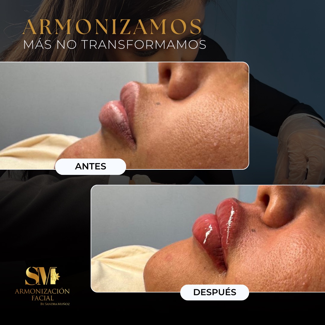 PROMO OCT - 15